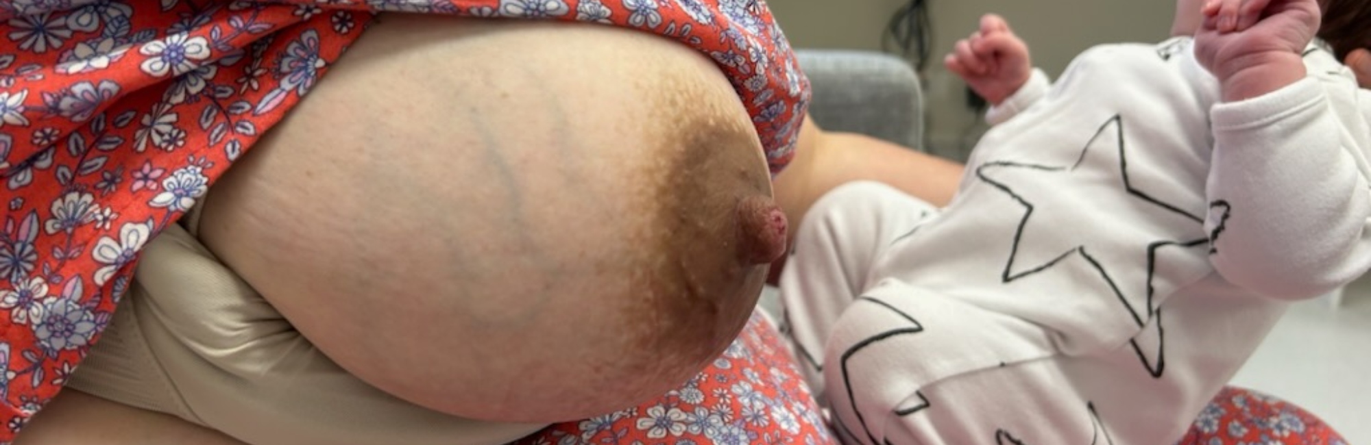 nipple pain; lactation; breastfeeding