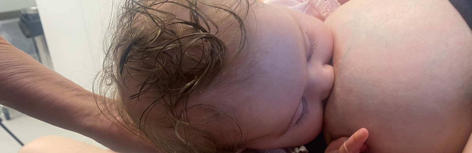 breast tissue drag; breastfeeding; lactation; baby breastfeeds