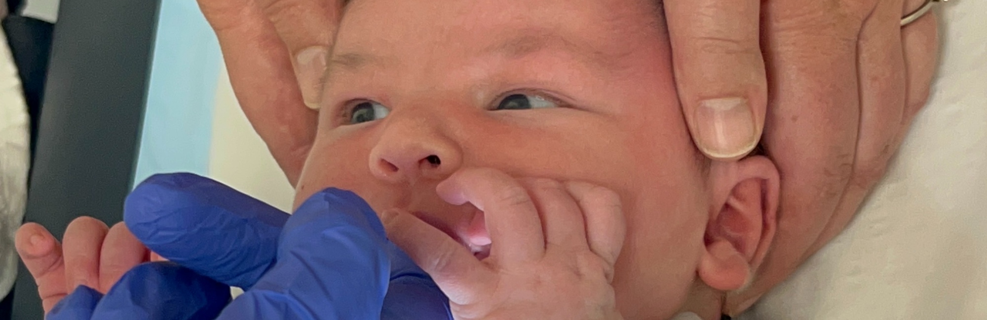 Suck assessment as adult secures baby's head