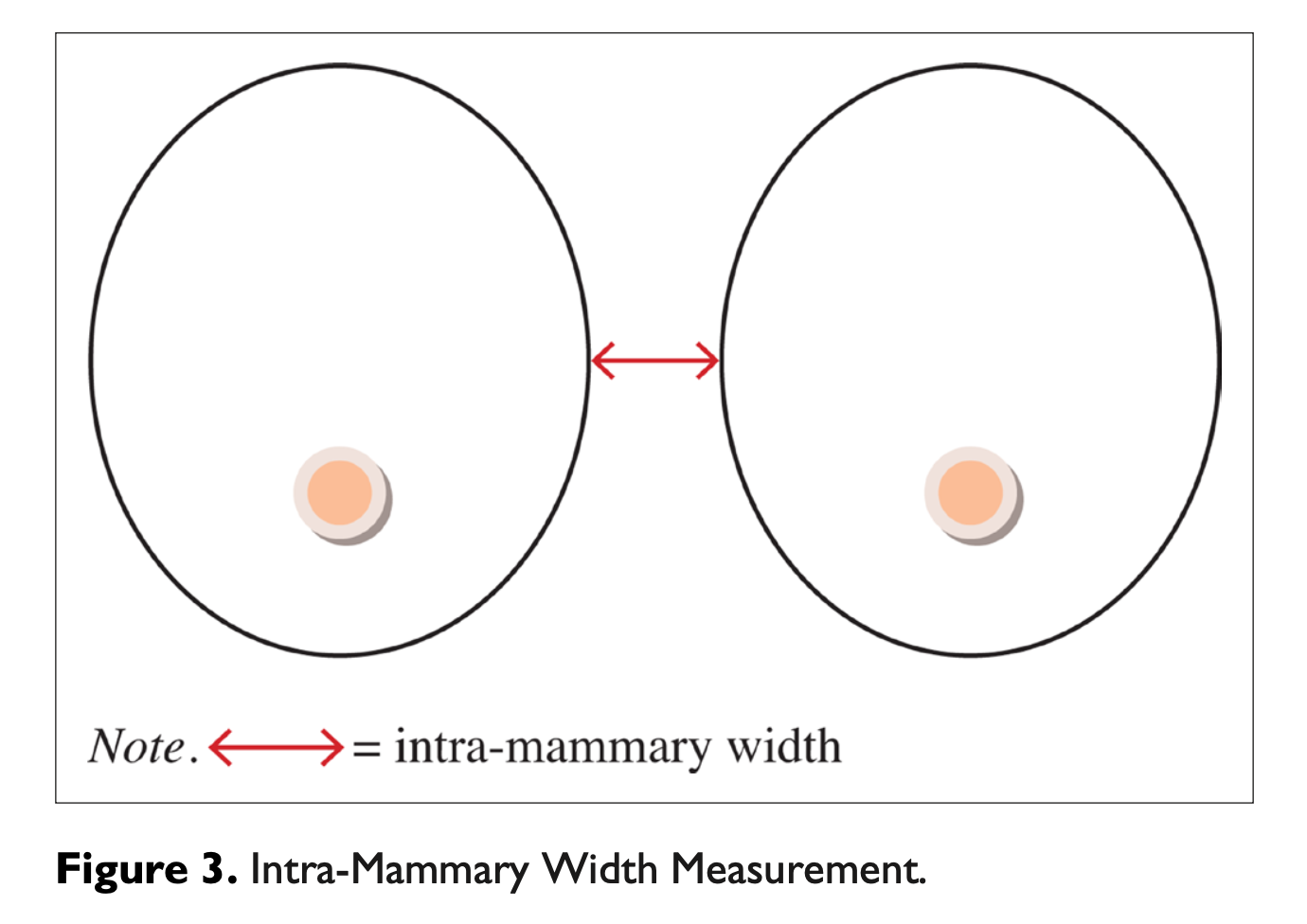 Intra-mammary width measurement